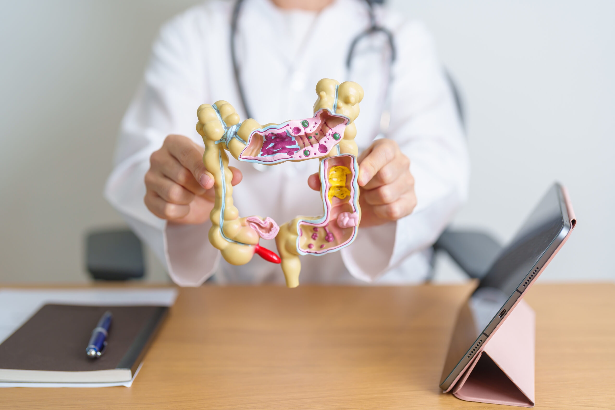 Doctor with human Colon anatomy model and tablet. Colonic disease, Large Intestine, Colorectal cancer, Ulcerative colitis, Diverticulitis, Irritable bowel syndrome and Digestive system